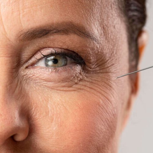 botox-injekcio-1.jpg botox-injekcio-1.jpg